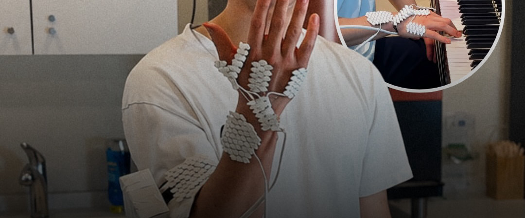 MIT System Uses AI and Muscle Stimulation to Directly Actuate Human Hands